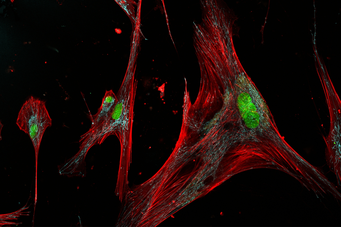 Are 'zombie' skin cells harmful or helpful? The answer may be in their shapes