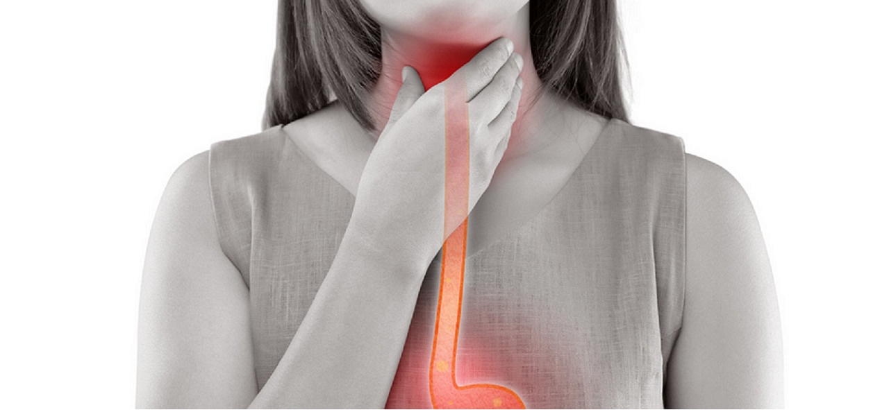 Researchers Develop Biomarker Algorithm for Barrett’s Esophagus and Esophageal Cancer