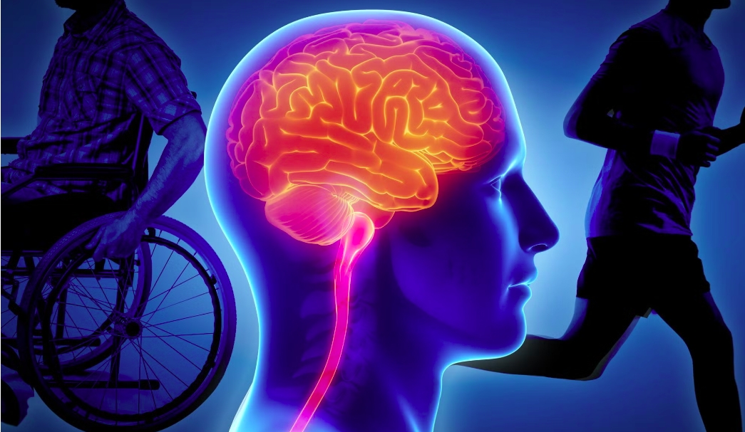 Genetic variant linked with faster progression of multiple sclerosis